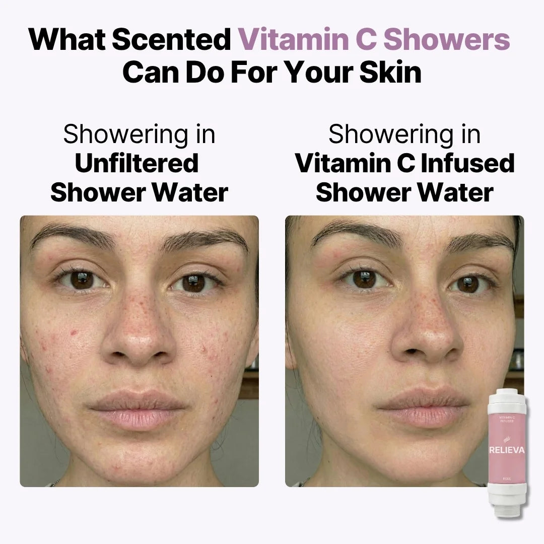 Vitamin C Shower Filter