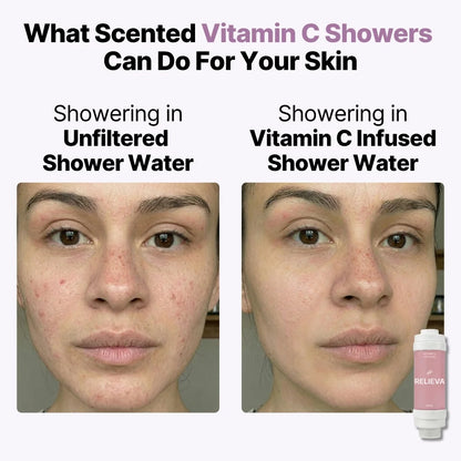 Vitamin C Shower Filter
